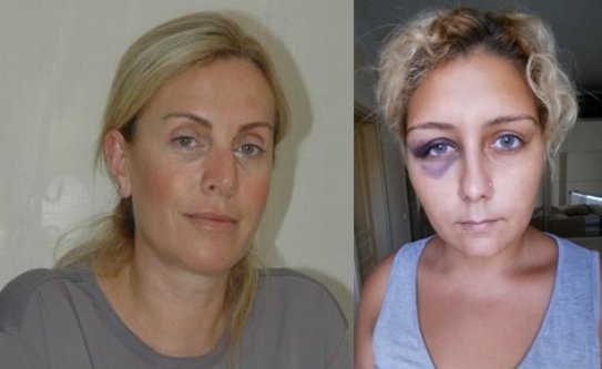 KENT KONSEYİNİN KÜBRA ÇIKIŞI