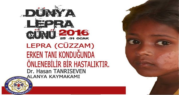 CÜZZAM HASTALIĞI UYARISI