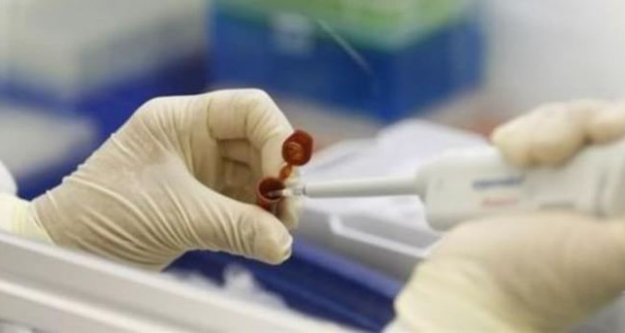 TTD’DEN DOMUZ GRİBİ AÇIKLAMASI