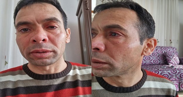 ANTRENÖRE EVİNDE ASİTLİ SALDIRI