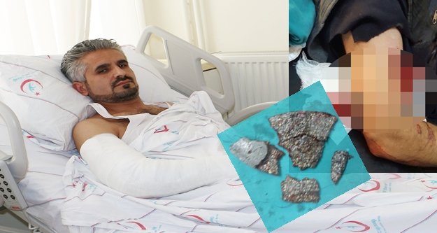 DÜZELTMEYE ÇALIŞTIĞI FREN BALATASI KOLUNA SAPLANDI