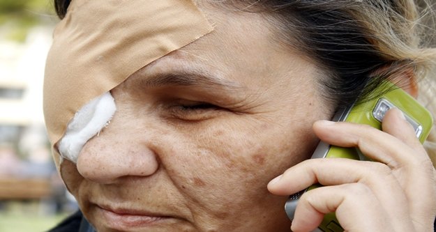 GÖZ TANSİYONU HAYATINI KARARTTI