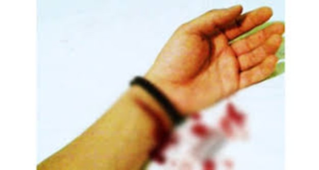 İNTİHARA TEŞEBBÜS ETTİ