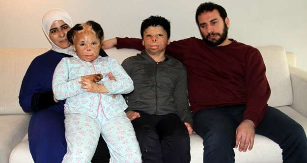 Suriyeli minikler Antalya'da şifa arıyor