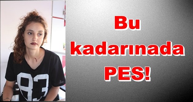 Sokakta genç kıza sigaralı saldırı