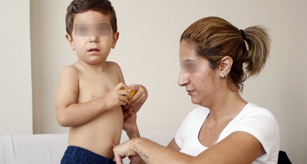 2 yaşındaki çocuğa kreşte darp