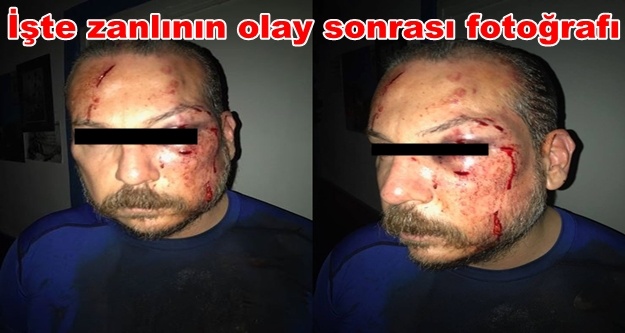 Otel sahibini öldüren zanlı yakalandı