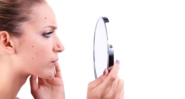 Doğal çözümlerle benlerinizden kurtulmanın 7 yolu