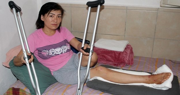 Otomobilin çarpıp kaçtığı kadının başına gelmeyen kalmadı