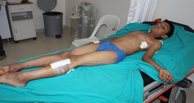 Bisiklet süren çocuğa köpek saldırdı