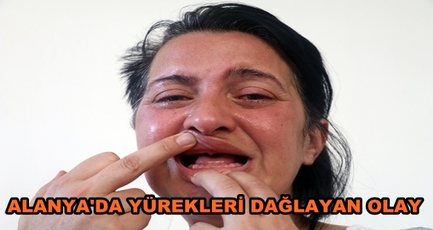 Bembeyaz dişleri olsun isterken 32 dişinden oldu