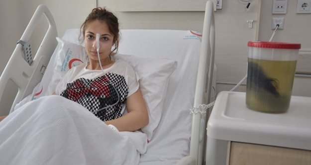Midesinden 1.5 kilogram ağırlığında saç yumağı çıktı