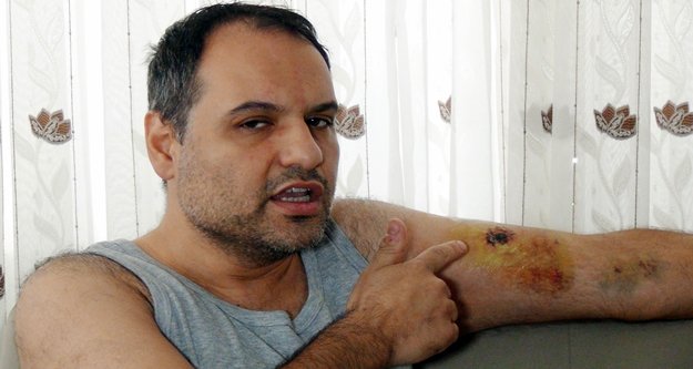 Tartıştığı hasta bakıcı tarafından kolundan ısırılan vatandaş hastanelik oldu