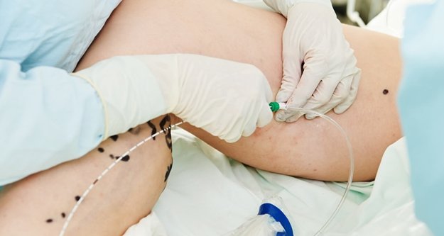 Kadınlarda daha sık görülüyor