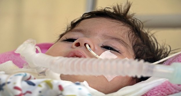 Elektrik kesintisi, ölümle burun buruna getiriyor