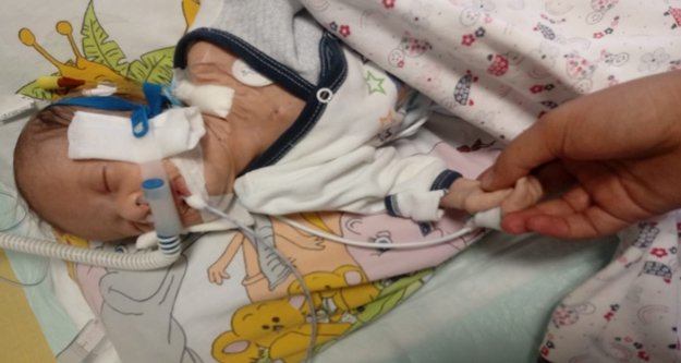 Alanya Mete bebek için seferber oldu!