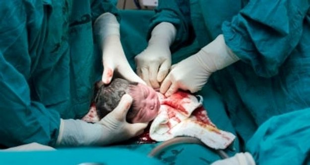 Sezeryan doğuma hükümet hamlesi