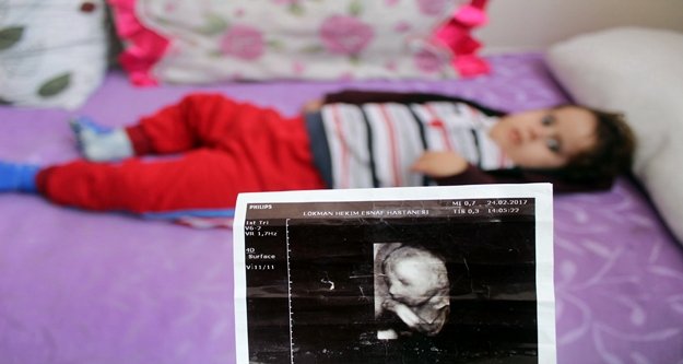 Çocukları için 2 yıldır hastaneden çıkamayan ailenin dramı yürekleri sızlattı!