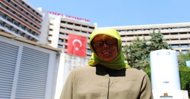 Yüz nakli heyecanı saran Leyla öğretmen olmak istiyor