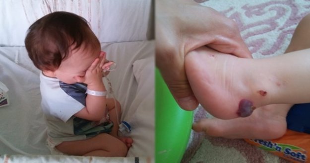 Alanya’da yaşayan minik Zeynep yardım bekliyor!