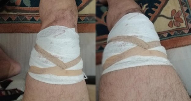 Alanya'da zabıta az kalsın bacaklarından oluyordu