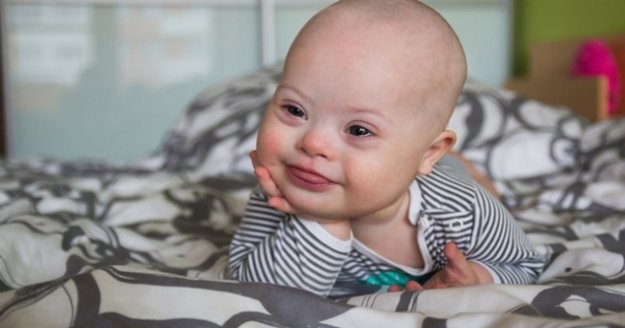 Down sendromu anne karnında belirlenebilir