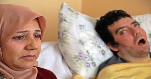 6 yıldır gözlerini kırpamıyor, kan çanağına dönen gözleri bantla kapatılıyor