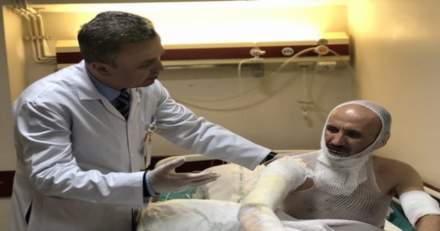 Uzmanlar uyarıyor, yanık durumlarında dikkat!