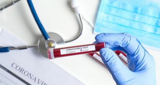 Alanya'da 532 kişiye antikor testi yapılacak