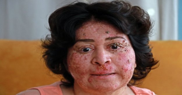 Artık telefondaki filtreler bile yüzü için yetersiz kalıyor