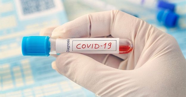 Bilim insanları, bazı kan gruplarının Covid-19'a karşı daha dirençli olduğunu tespit etti
