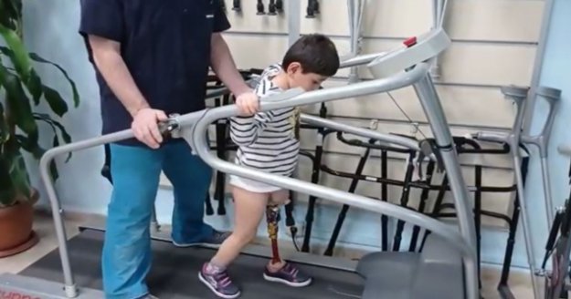 “Baba koşabilecek miyim?” diye sordu, yeni protezine kavuştu