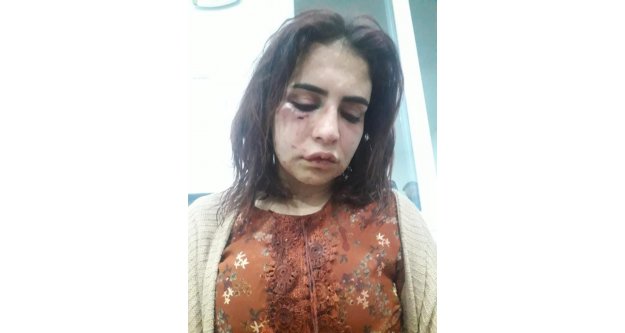 Alanya'da eski sevgilisi tarafından darp edilen genç kızın “Ölmek istemiyorum” paylaşımı