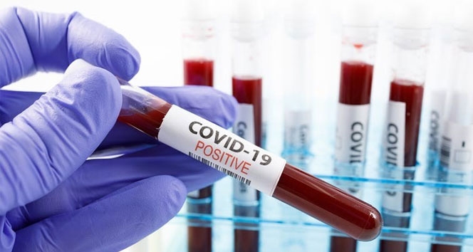 Koronovirüste son veriler açıklandı