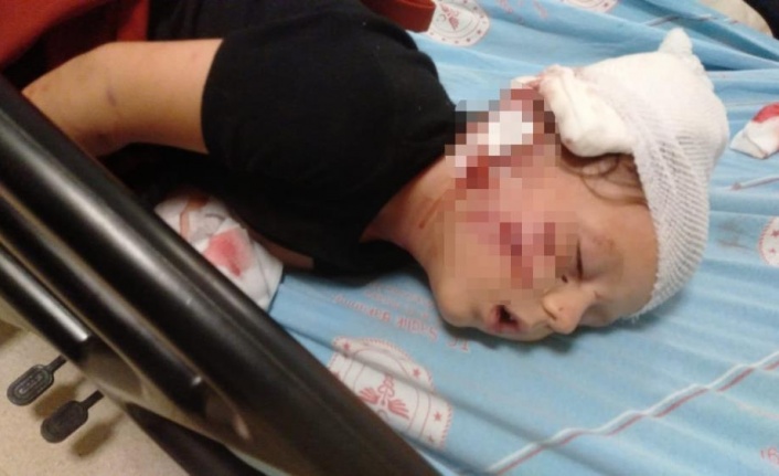 Minik Yağız'ın köpeğin saldırısına uğrayıp ölümden döndüğü o anlar güvenlik kamerasında