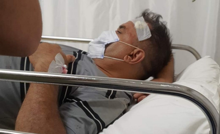 Alanya'da eski başkan vekili kaza yaptı