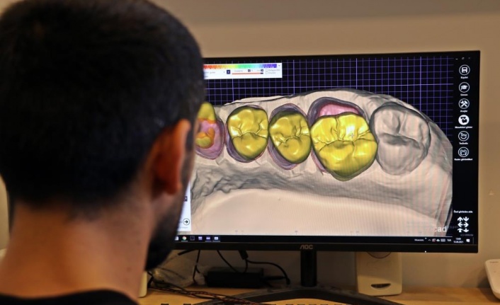 Uzm. Dr. Onur Ademhan: "Aynı günde çekim, implant ve diş takılması mümkün"