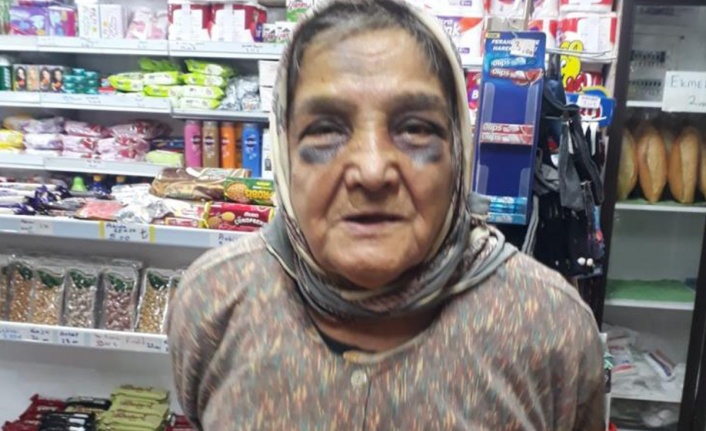Demir çubukla dövdüğü 73 yaşındaki eşini, bakın ne hale soktu