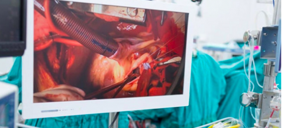 ALKÜ EAH'da ilk bypass ameliyatı yapıldı