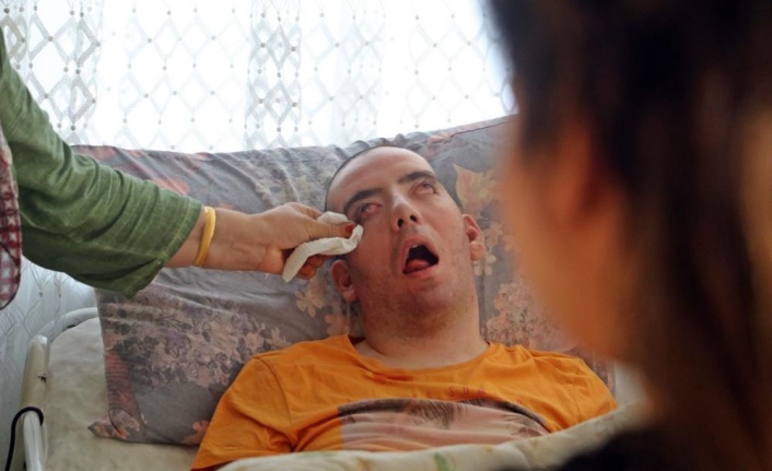 Doktorlar 6 ay ömür biçti, 10 yıldır gözlerini bir an olsun kırpmadan yaşam savaşı veriyor