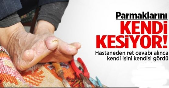 Kendi Parmaklarını Kendi Kesiyor