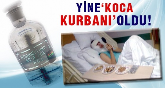 Kocası bu hale getirdi!