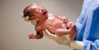 Riskli bebeklerde erken müdahale