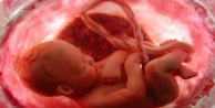 Anne karnında kalp hastalığı tanısı mümkün