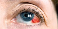 Uzmanlardan göz tansiyonu uyarısı!