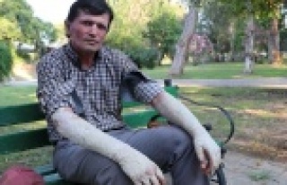 23 yıldır sedef hastalığıyla mücadele ediyor