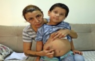 5 yaşındaki hiperaktif çocuğa kreşte darp iddiası