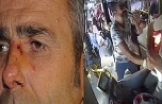 Tartıştığı kadının eşi şoförün burnunu...