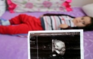 Çocukları için 2 yıldır hastaneden çıkamayan...
