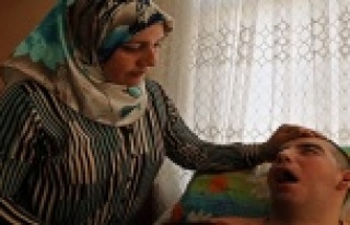 5 yıldır gözlerini kırpamıyor, adeta kan ağlıyor